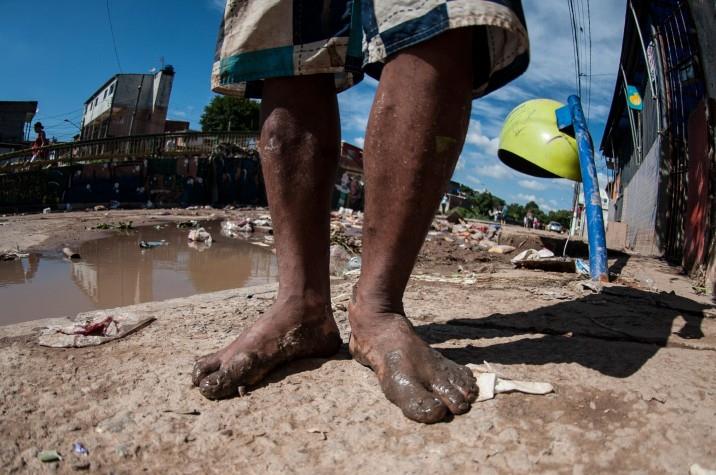 Porto Alegre emite alerta epidemiológico sobre risco de leptospirose