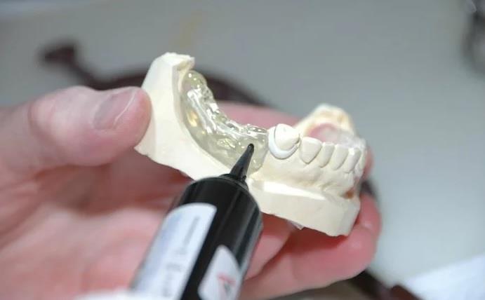 Próteses e implantes dentários: conheça as diferenças