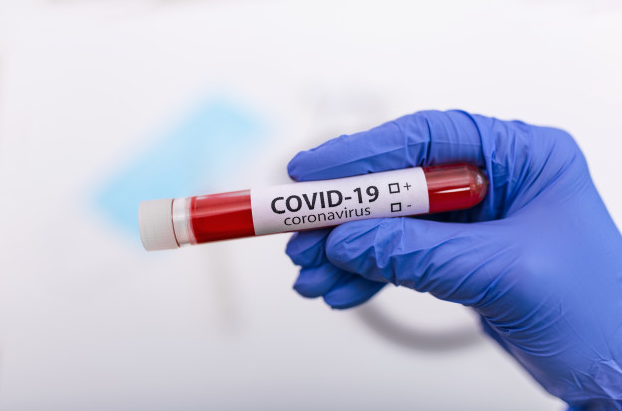 Arauto Saúde: a importância dos testes da Covid-19 durante a pandemia