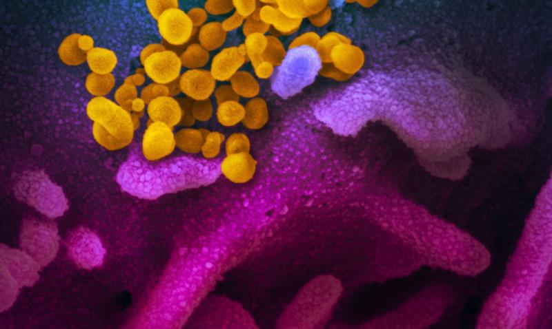 Covid-19: estudo aponta aumento de bactérias resistentes em UTIs